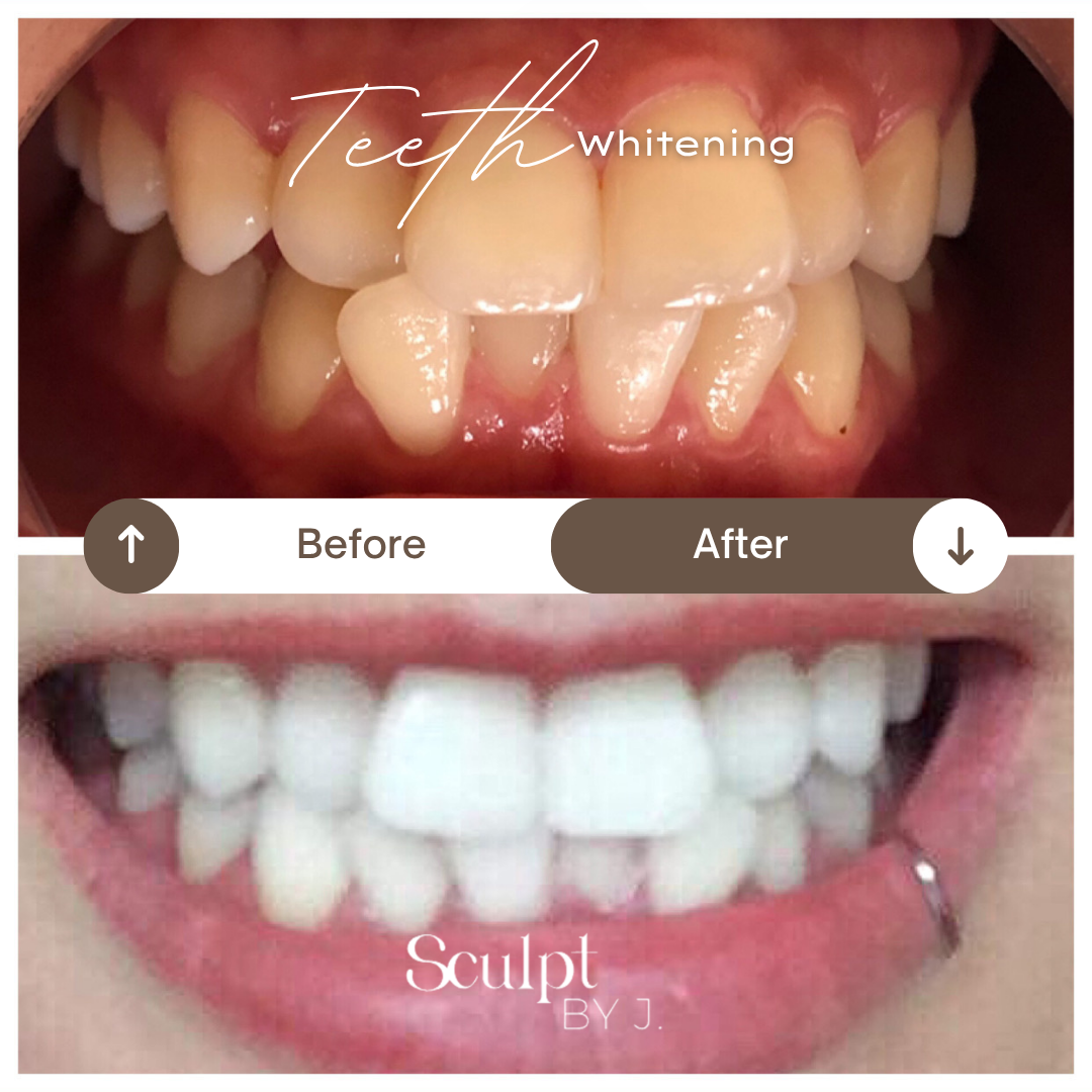 Thuzzle-Resurfacing_2