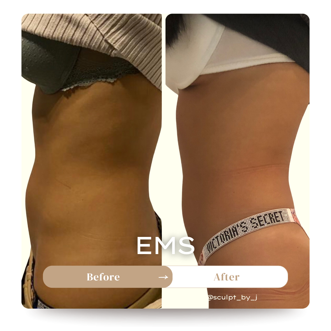 Thuzzle-Resurfacing_2