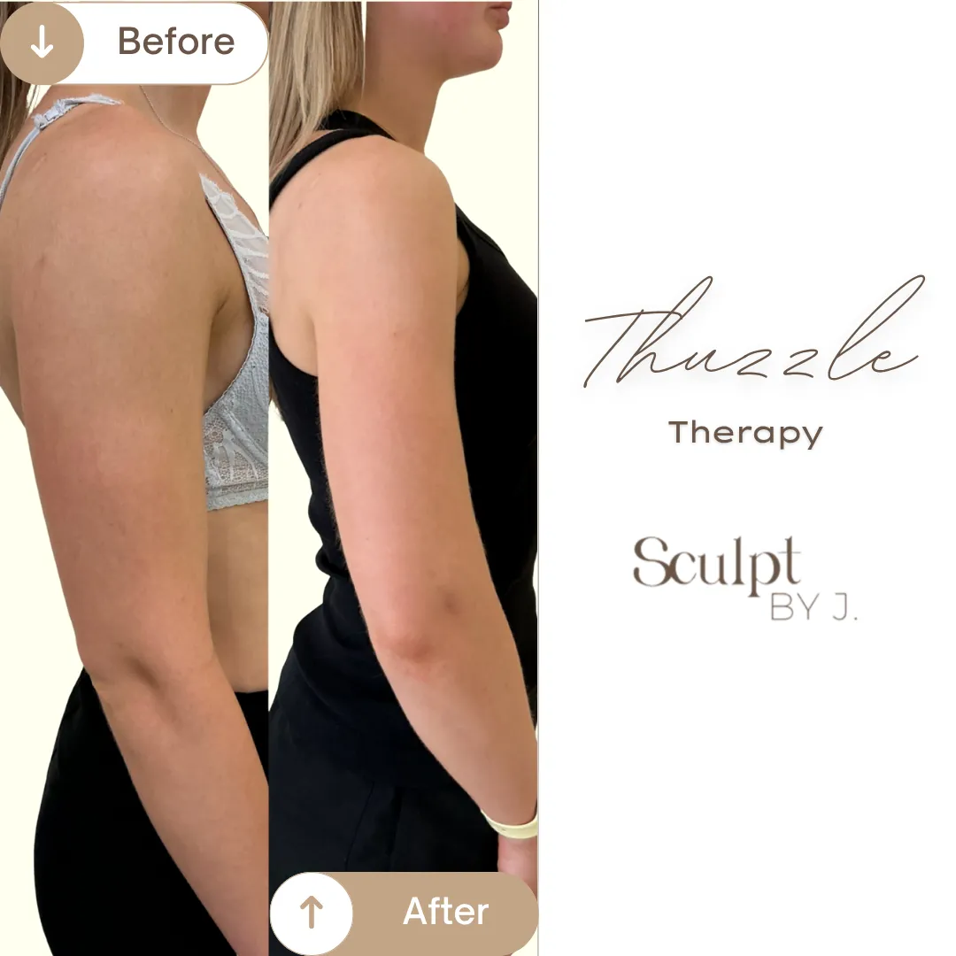 Thuzzle Body Tightening Result