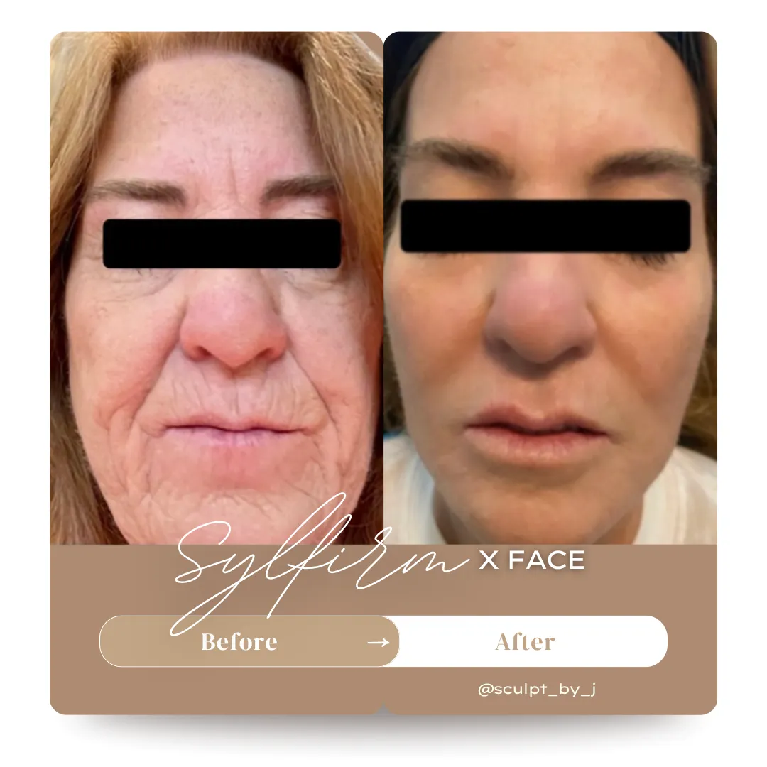 Comprehensive Facial Rejuvenation
