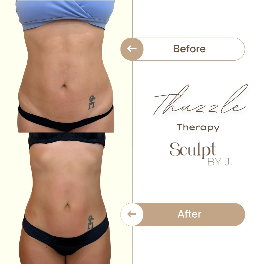 Vascularisation Abdominal Result