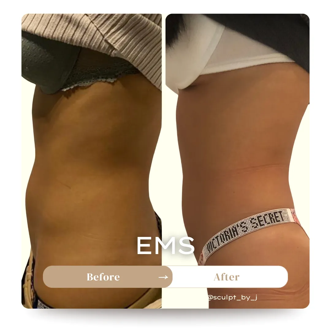 EMS Muscle Sculpt
